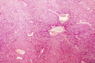 Light micrograph of a human liver clipart