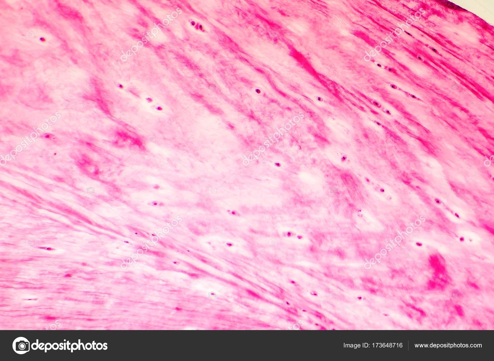 Resultado de imagem para cartilagem fibrosa