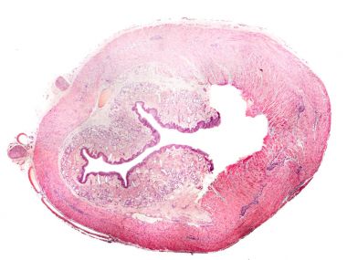 Cross-section of human esophagus clipart