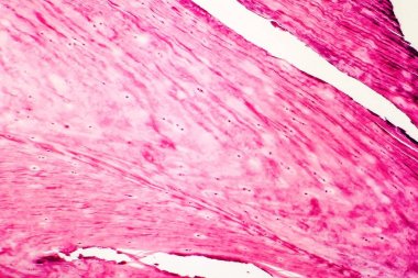 Fibröz kıkırdak, ışık test