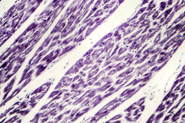 Muscle cardiaque humain, micrographie photonique — Photo