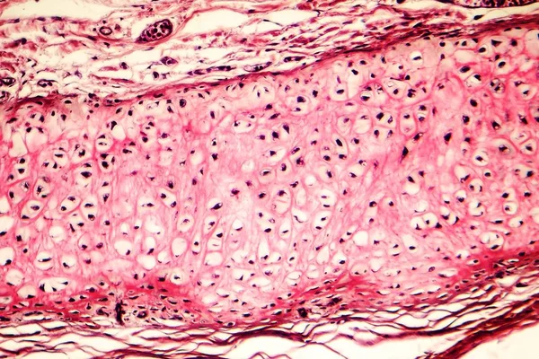 Rugalmas porc-ból emberi külső fül — Stock Fotó