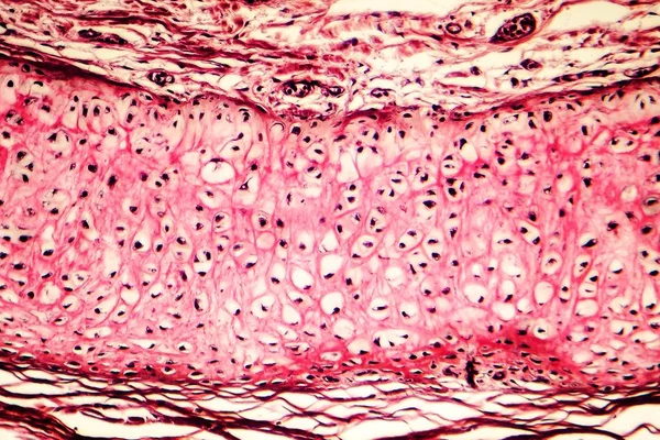 Cartilage élastique de l'oreille externe humaine — Photo