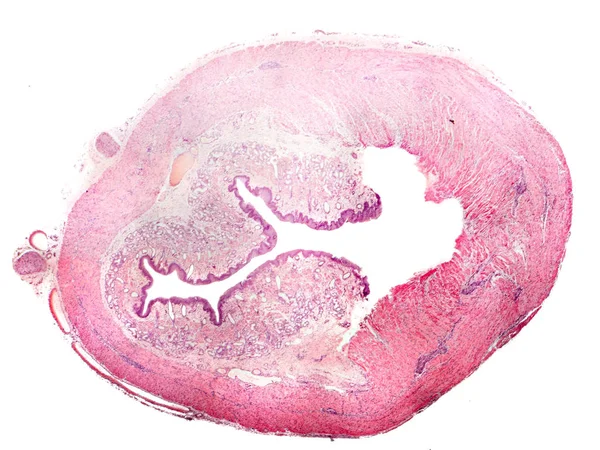 Coupe transversale de l'œsophage humain — Photo