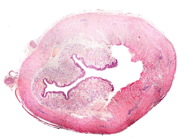 Corte transversal del esófago humano — Foto de Stock