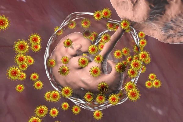 Perinatal transmission of HIV infection, conceptual image