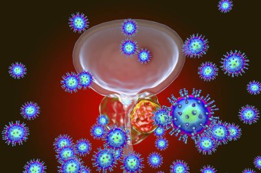 Prostat kanserinin viral ethiology için kavramsal görüntü