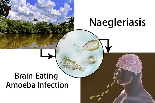 Flagellate form of the parasite Naegleria fowleri — Stock Photo, Image