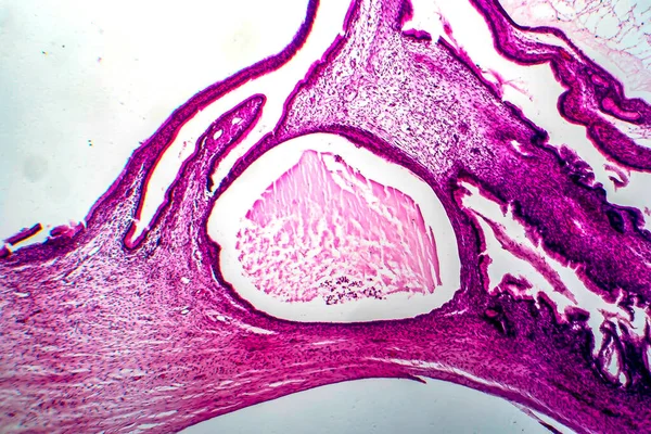 Cystadénome Muqueux Ovarien Tumeur Bénigne Ovaire Micrographie Photonique Photo Microscope — Photo