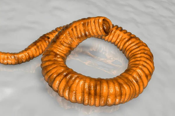 Dracunculus Medinensis Larvae Excreted Female Worm Parasiting Skin Human Extremities — 스톡 사진