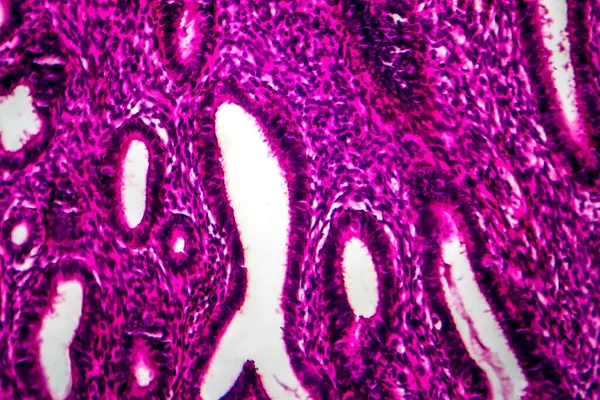 Endometriyal Hiperplazma Işık Mikrografı Mikroskop Altında Fotoğraf — Stok fotoğraf