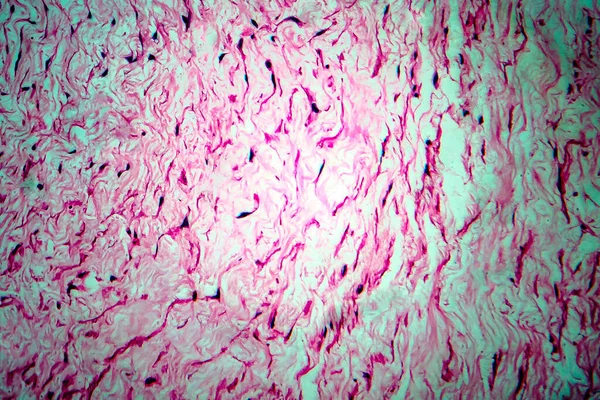 卵巣嚢胞 光マイクログラフ 顕微鏡下の写真 — ストック写真