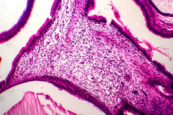 Ovarian mucinous cystadenoma, a benign tumor of ovary, light micrograph, photo under microscope