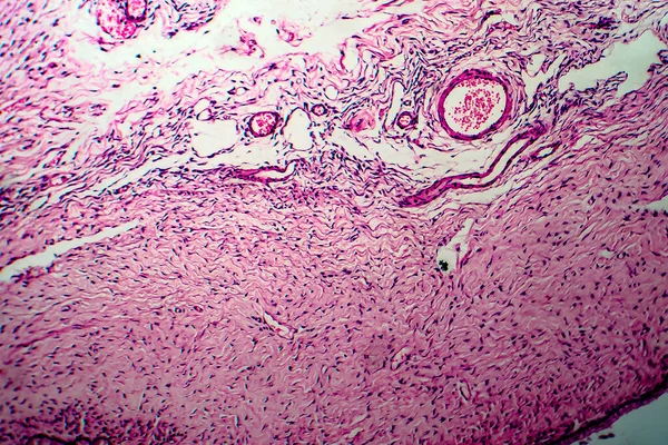 Cisti Ovarica Micrografo Luce Foto Microscopio — Foto Stock