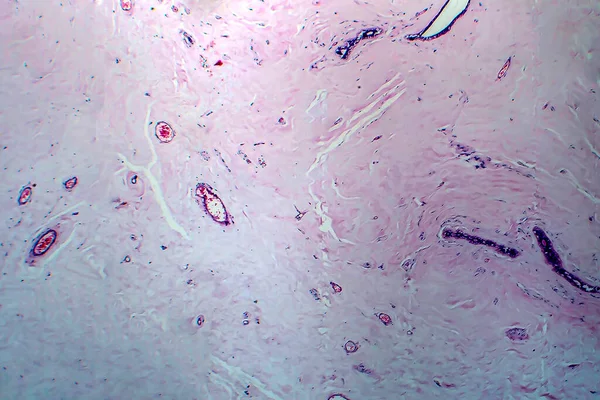 Uterus Adenofibroma Light Micrograph Photo Microscope 분비선 조직으로 구성된 자궁의 — 스톡 사진