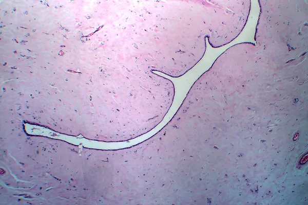 Uterus Adenofibroma Light Micrograph Photo Microscope 분비선 조직으로 구성된 자궁의 — 스톡 사진