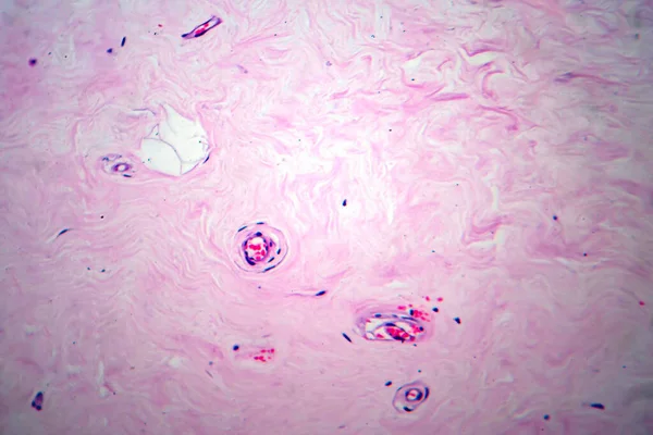 Uterus Adenofibroma Light Micrograph Photo Microscope 분비선 조직으로 구성된 자궁의 — 스톡 사진