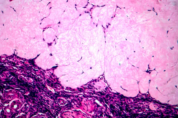 Ovarian Follicular Cyst Light Micrograph Photo Microscope — 스톡 사진