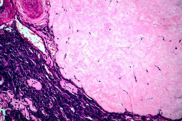Chist Folicular Ovarian Micrograf Luminos Fotografie Sub Microscop — Fotografie, imagine de stoc