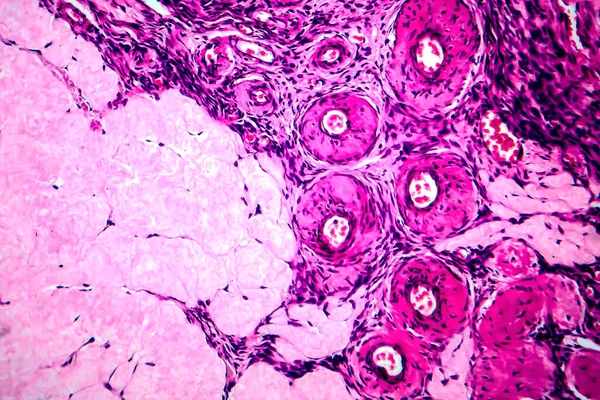Ovarium Folliculair Cyste Licht Micrograaf Foto Onder Microscoop — Stockfoto