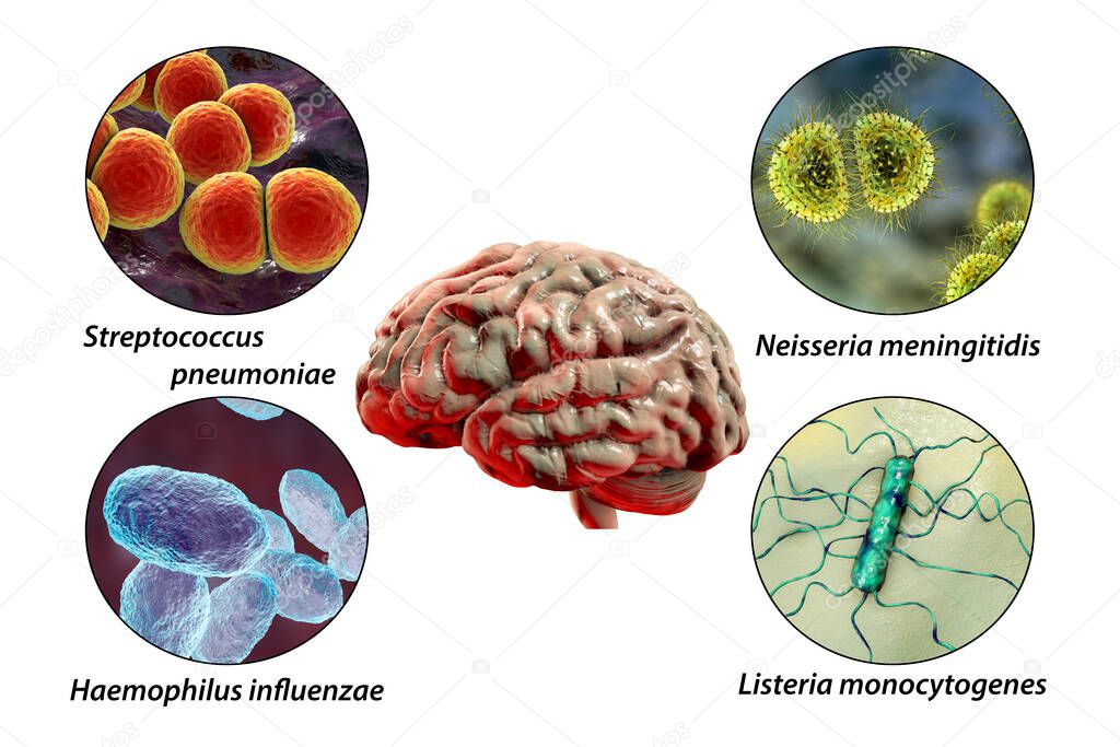 Etiology of bacterial meningitis, 3D illustration. Neisseria meningitidis, Streptococcus pneumoniae, Haemophilus influenzae and Listeria monocytogenes bacteria