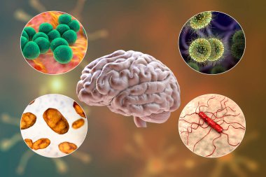 Bakteriyel menenjit etiyolojisi, 3 boyutlu illüstrasyon. Neisseria meningitidis, Streptococcus pneumoniae, Haemophilus influenzae ve Listeria monocytogenes bakterileri