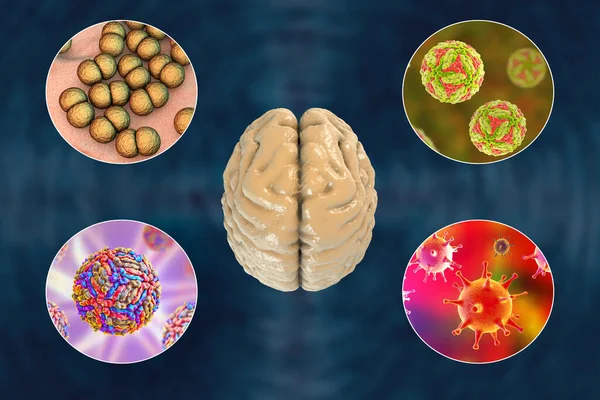 脑感染 引起脑炎和脑膜炎的微生物 — 图库照片