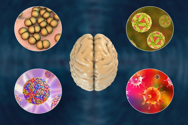 Brain Infections Microorganisms Cause Encephalitis Meningitis — Stock Photo, Image