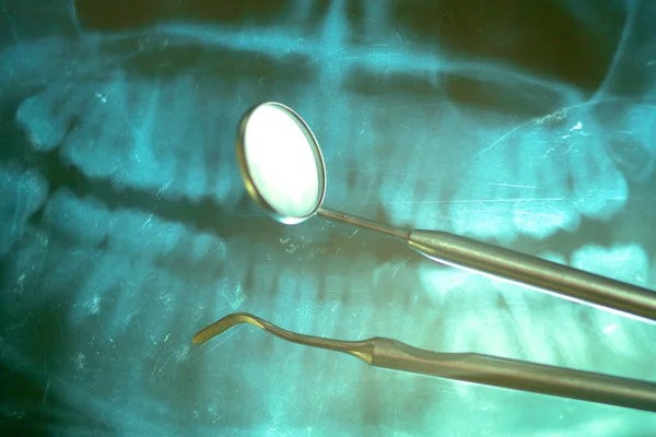 Instrumenty stomatologiczne leżą na podświetloną x-ray — Zdjęcie stockowe