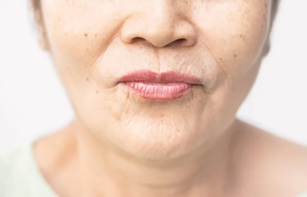 Enrugado de idade asiático mulher pele — Fotografia de Stock