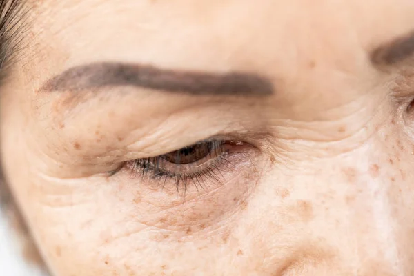 Wrinkled of old asian woman skin eyelid — Stock Photo, Image