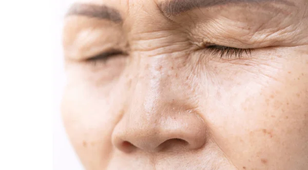 Wrinkled of old asian woman skin eyelid — Stock Photo, Image