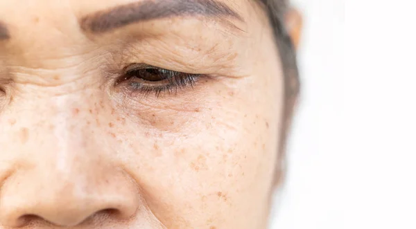 Wrinkled of old asian woman skin eyelid — Stock Photo, Image