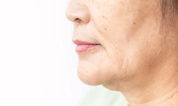 Wrinkled of old asian woman skin — Stock Photo, Image