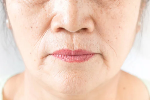 Wrinkled of old asian woman skin — Stock Photo, Image