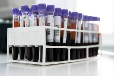 Milan, İtalya - 17 Mart 2020: Analiz laboratuvarında bir rafta kan tüplerinin sıralanması