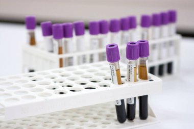 Milan, İtalya - 17 Mart 2020: Analiz laboratuvarında bir rafta kan tüplerinin sıralanması