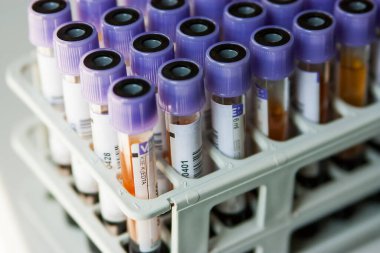 Milan, İtalya - 17 Mart 2020: Analiz laboratuvarında bir rafta kan tüplerinin sıralanması