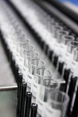 Milan, İtalya - 17 Mart 2020: Bir hastanede tıbbi laboratuvar analizi için test tüpleriyle rafların hazırlanması