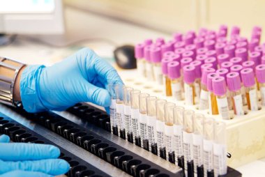 Milan, İtalya - 17 Mart 2020: Kan tüplerini analiz laboratuvarında raflarda sıralayan operatörler