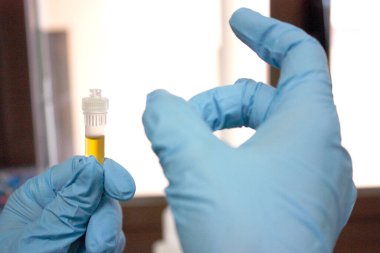 Milan, İtalya - 17 Mart 2020: Analiz laboratuarında test tübü plazmayla el ele