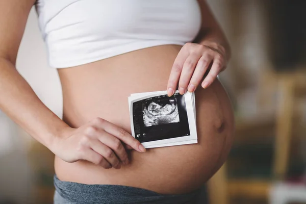 Mujer embarazada esperando un recién nacido — Foto de Stock