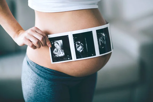 Mujer sosteniendo ecografías en el vientre — Foto de Stock