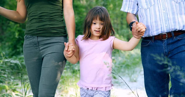 Fille avec le syndrome du duvet marche avec les parents — Photo