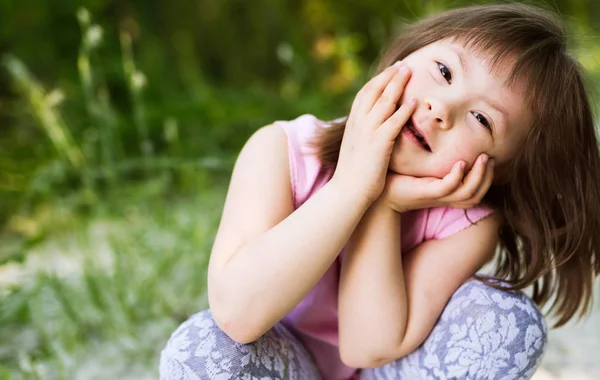Маленькая девочка с синдромом Дауна — стоковое фото