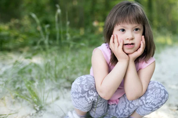 Young girl with down syndrome — Stock Photo, Image