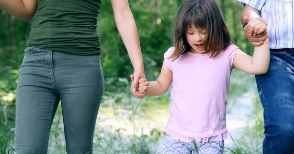 Liten flicka med Downs syndrom — Stockfoto