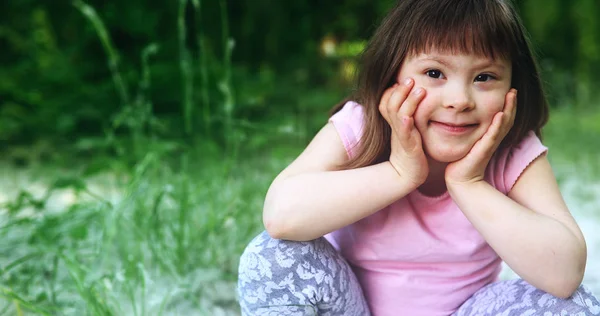 Маленькая девочка с синдромом Дауна — стоковое фото