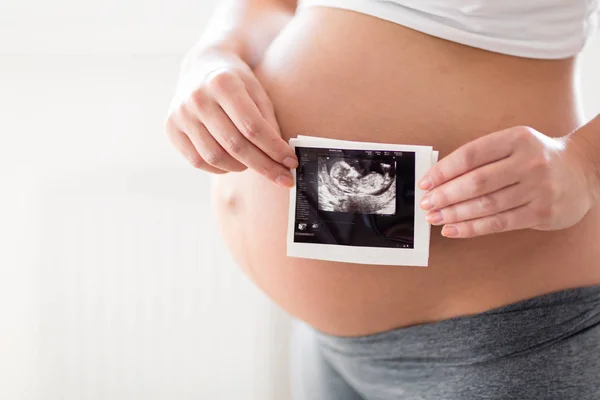 Pregnant woman holding ultrasound photo on her belly