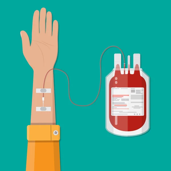 Bolsa con sangre y mano de donante. concepto de donación — Vector de stock